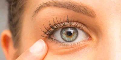 cure blepharitis eyelid inflammation