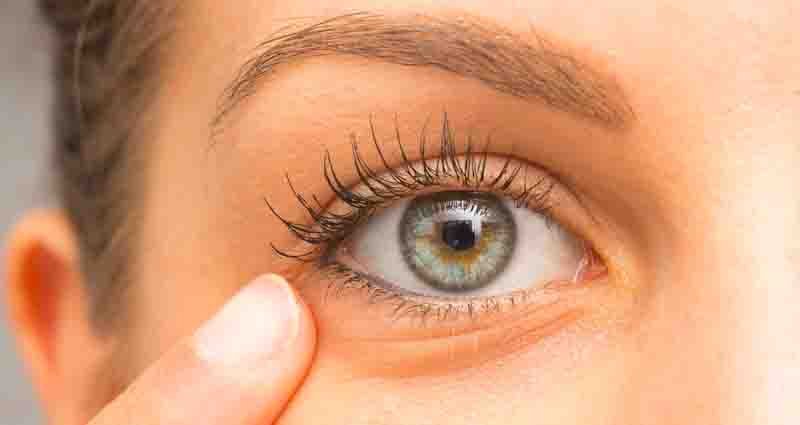 cure blepharitis eyelid inflammation