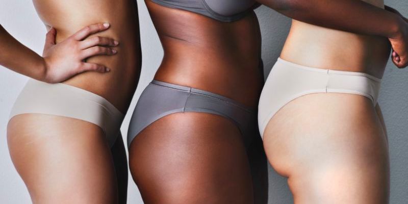 how to make stretch marks fade faster