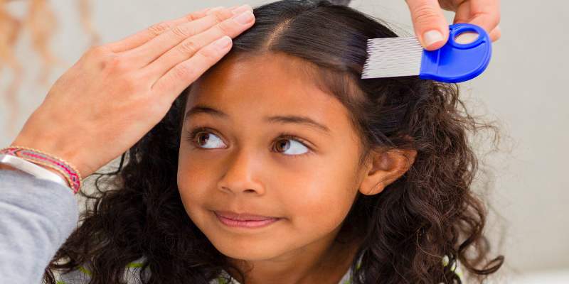 treat head lice with home remedies