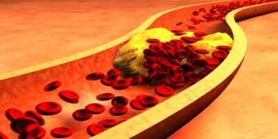 How to increase HDL cholestorol