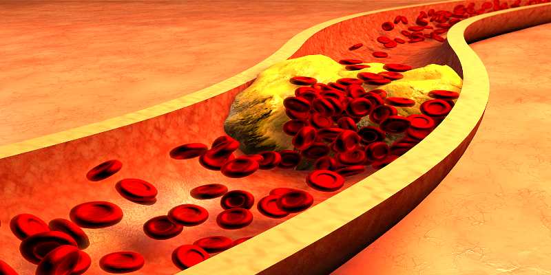 How to increase HDL cholestorol