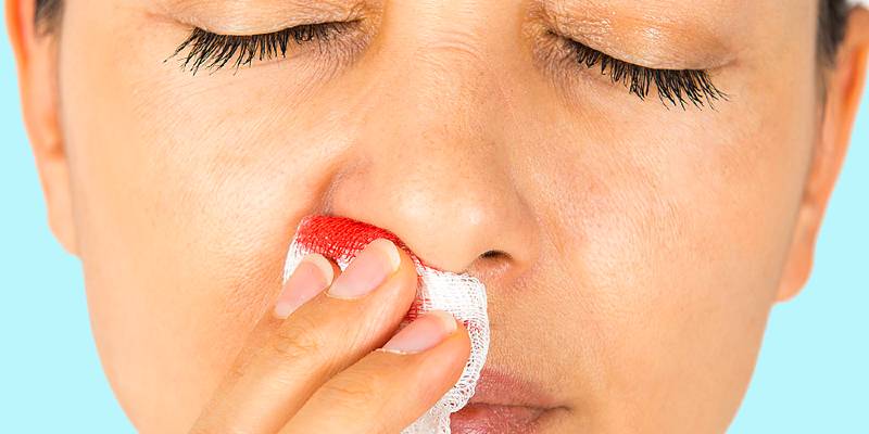 How to stop nose bleeds