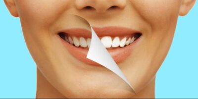 how to whiten teeth naturally (1)