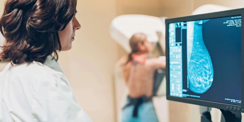 mammogram